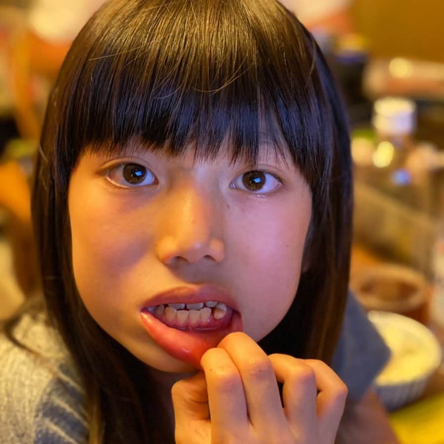 片桐仁のインスタグラム：「乳歯が抜けたとさ」